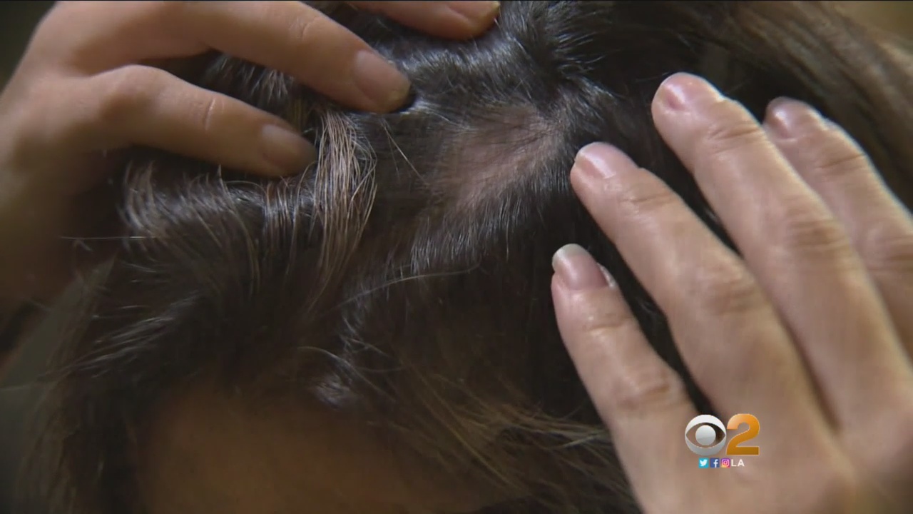Class Action Lawsuit Over Wen Hair Products Gets Preliminary Settlement Approval Cbs Los Angeles